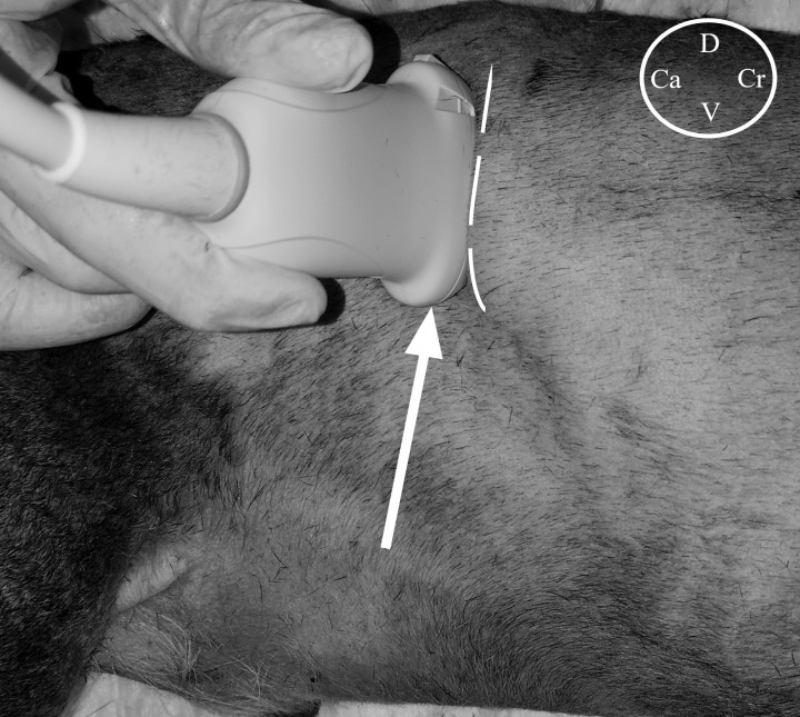 <p>Abordaje ecoguiado del plano dorsal del músculo cuadrado lumbar a nivel de la vértebra L1. El transductor fue posicionado paralelo y caudal a la última costilla, con el marcador localizado dorsalmente, y ligeramente orientado en dirección ventrodorsal. La flecha blanca indica la dirección de la aguja empleando una técnica “en plano”. Cr: craneal; Ca: caudal; D: dorsal; V: ventral. La línea blanca discontinua indica la posición de la última costilla.</p>