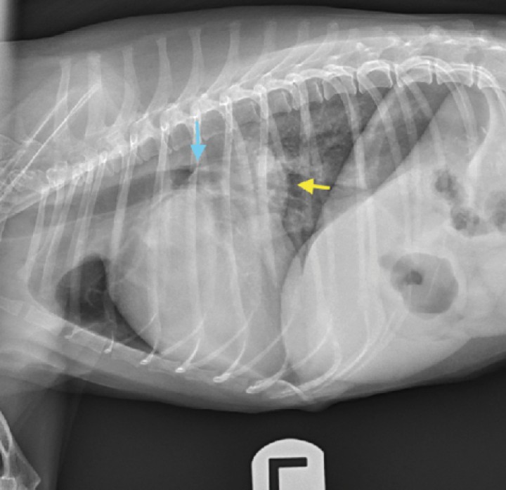 <p>Radiografía lateral izquierda de un perro con cardiomegalia (VHS = 12,5 CV) y dilatación de atrio izquierdo. Se observa un aumento de opacidad de tejido blando entre las 12 y las 2 de la silueta cardiaca, según la cronología del reloj, compatible con un aumento del tamaño del atrio izquierdo (flecha amarilla). Se observa además el desplazamiento dorsal de la tráquea, así como la compresión del bronquio principal izquierdo (flecha azul). VHS: <em>Vertebral Heart Score</em>; CV: cuerpos vertebrales.</p>