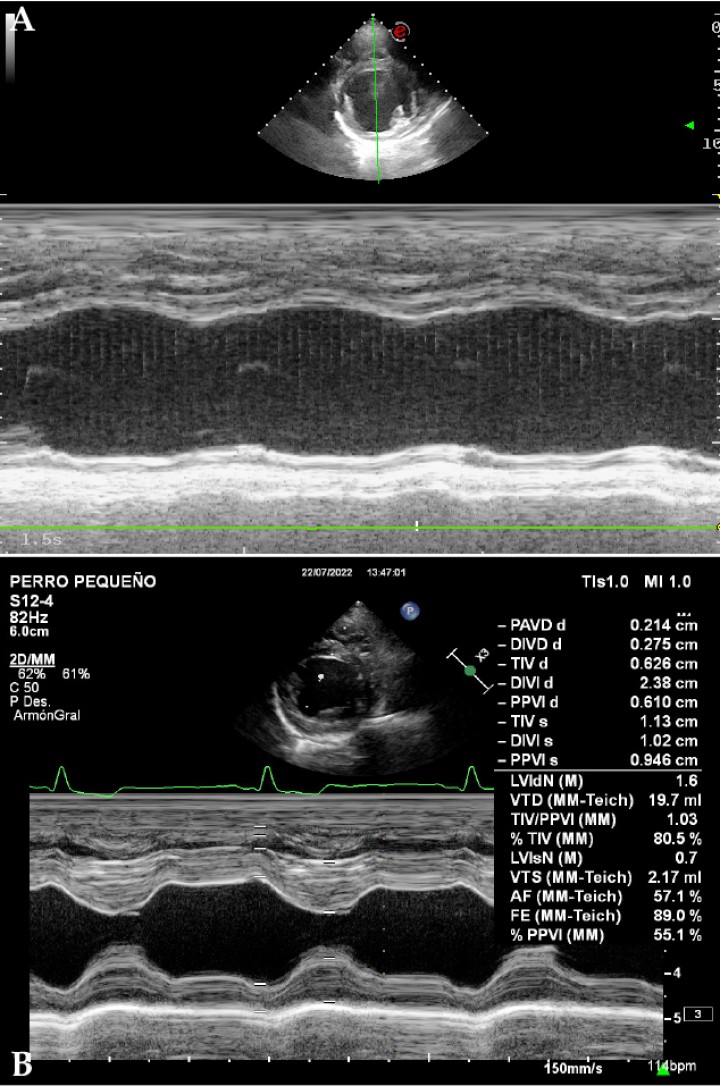 <p>(<strong>A</strong>) Imagen ecocardiográfica en modo M, paraesternal derecha en eje corto a la altura de los músculos papilares del ventrículo izquierdo de un perro con cardiomiopatía dilatada. Nótese la ausencia de contracción ventricular en comparación con la misma imagen en un paciente sano. (<strong>B</strong>) Imagen ecocardiográfica en modo M, paraesternal derecha en eje corto a la altura de los músculos papilares del ventrículo izquierdo de un perro sano. Se observa el diámetro del ventrículo izquierdo en diástole normalizado (LVIDn) con un valor de 1,6. Este es un valor normalizado del diámetro de ventrículo izquierdo en diástole (LVIDD) en función del peso mediante la siguiente fórmula: LVIDn= LVIDD / Peso 0,294. El valor de referencia se sitúa por debajo de 1,7 cm.</p>