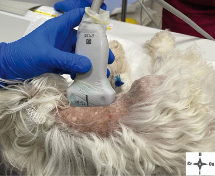 <p>Posicionamiento de la sonda ecográfica.</p>