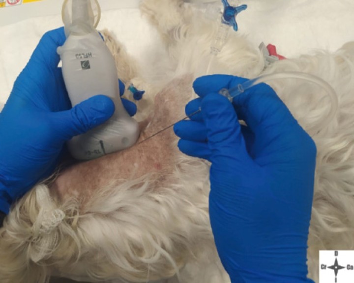 <p>Abordaje en plano para realizar el bloqueo.</p>