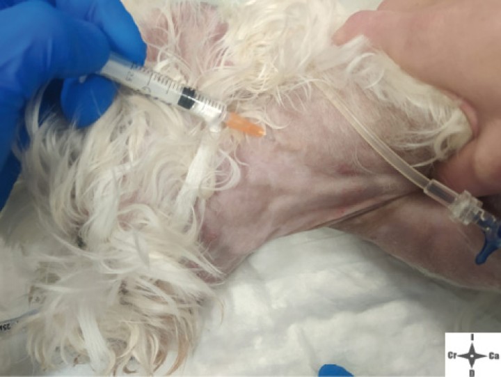 <p>Inyección contralateral subcutánea de ramas superficiales de C<sub>2</sub>.</p>