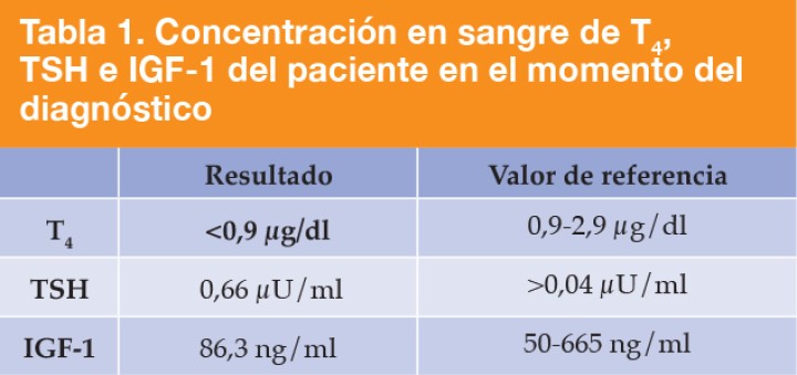<p>T<sub>4</sub>: Tiroxina T<sub>4</sub>; TSH: Hormona Estimulante del Tiroides; IGF-1: Somatomedina C. En negrita aparecen los valores fuera de rango</p>