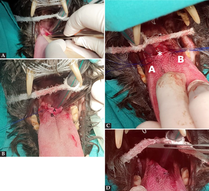 <p>Secuencia de la realización de la técnica de epliglotopexia incisional. (<strong>A</strong>) Detalle de la realización de la incisión en el aspecto lingual de la epiglotis. (<strong>B</strong>) Detalle de las estructuras anatómicas sobre las que se lleva a cabo la técnica quirúrgica. A: epiglotis; B: base de la lengua. (<strong>C</strong>) Detalle de las suturas de la epiglotis a la base de la lengua incluyendo al cartílago epiglótico (A-B) y epiglotis (*). (<strong>D</strong>) Detalle final del posicionamiento horizontal de la epiglotis respecto a la lengua mediante sutura por puntos simples incluyendo al cartílago epiglótico.</p>