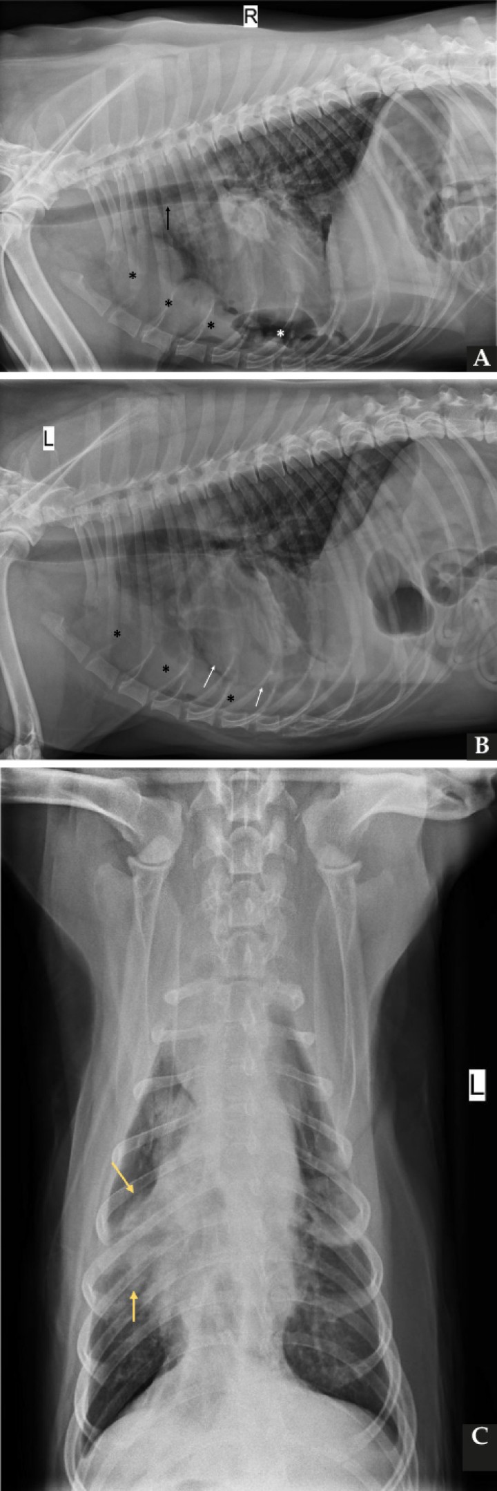 <p>Mismas imágenes que en Figura 1. Se observa una silueta de opacidad líquido/tejido blando (asteriscos negros) en el mediastino craneoventral, produciendo elevación dorsal de la tráquea (flecha negra) y desplazamiento en sentido caudodorsal de la silueta cardiaca (flechas blancas) (<strong>A</strong> y <strong>B</strong>). Además, se aprecia atelectasia del lóbulo medio derecho (flechas amarillas) (<strong>C</strong>) y pequeñas estructuras de opacidad gas (asterisco blanco) (<strong>A</strong>).</p>