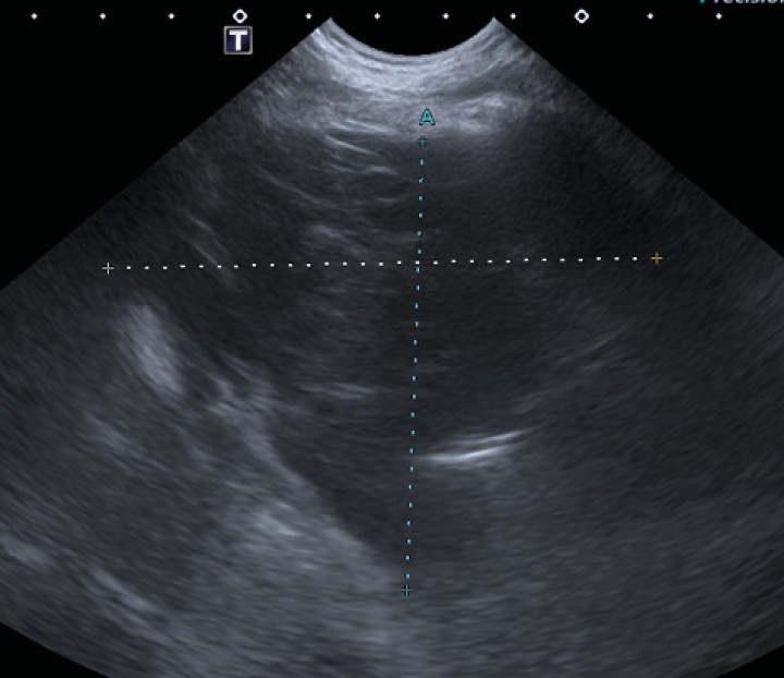 <p>Ecografía torácica en la que se observa una masa heterogénea y principalmente hipoecoica en el mediastino craneal.</p>