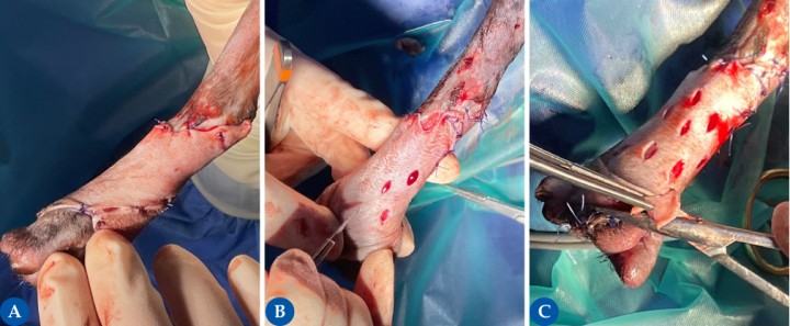 <p>En la figura 5<strong>A</strong> se muestra la aplicación del injerto de espesor completo obtenido. Se suturan los bordes del injerto mediante el uso de un patrón interrumpido simple o en X. En la figura 5<strong>B</strong> se muestra el injerto de espesor completo y la realización de las incisiones para su conversión a injerto en malla, el cual está recomendado en la mayoría de los casos ya que permite el drenaje del injerto y confiere elasticidad, adaptabilidad y expansión. Las incisiones pueden realizarse también antes de la aplicación del injerto sobre la herida. Para ello, se realizan incisiones paralelas y en fila escalonada de 1 a 2 cm de longitud y entre 0,5 a 2 cm de separación entre uno y otro. Para obtener una mejor estética, se recomienda realizar estas incisiones siguiendo las líneas de tensión de la piel. Tras realizar las incisiones, el injerto se expande y los bordes del injerto sobrantes en la zona distal se recortan (Fig. 5<strong>C</strong>).</p>