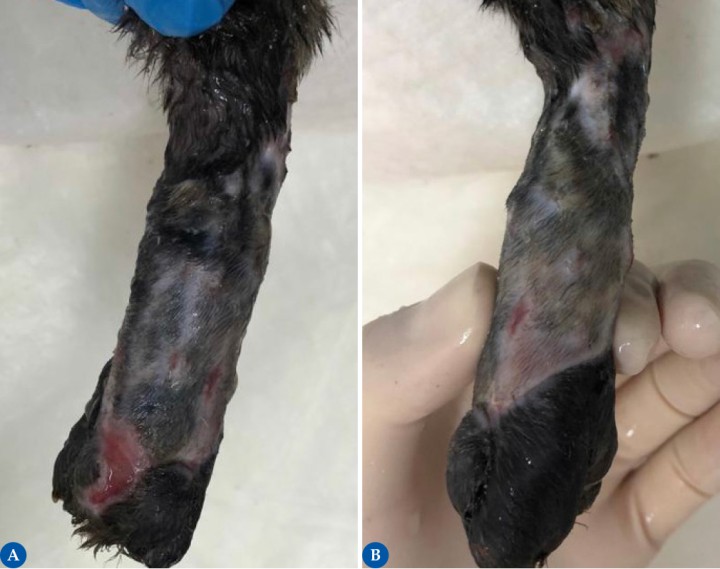 <p>Injerto de espesor completo en malla a las 4 semanas tras la intervención quirúrgica, cara dorso-medial (Fig. 8<strong>A</strong>) y plantar (Fig. 8<strong>B</strong>). Las imágenes muestran una cicatrización casi completa del injerto (las incisiones en malla están cercanas a la epitelización completa, pero aún se observan pequeñas zonas con tejido de granulación), adquiriendo un color, textura y elasticidad similar al lecho receptor. En el presente caso, casi el 100 % del injerto fue aceptado con éxito. Las causas más comunes por las que se produce un fallo del injerto son una inadecuada inmovilización, infección y separación del lecho por fluidos. Todo ello impide la nutrición y revascularización del injerto. La acumulación de líquido separa mecánicamente el injerto de su lecho receptor. La ventaja que ofrecen los injertos en malla es que no requieren de la colocación de drenajes para vaciado, permitiendo un drenaje continuo. Los cambios de vendaje frecuentes y de manera minuciosa y estéril ayudarán a prevenir la infección o monitorizarla y tratarla si esta aparece.</p>