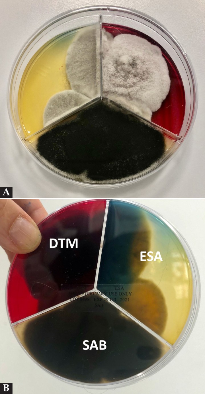 <p>(<strong>A</strong>) Imagen de la placa de Petri con medios para crecimiento fúngico: Sabouraud (SAB)/ medio para dermatofitos (DTM) y agar estimulante de la esporulación (ESA), obtenido de las lesiones faciales y con crecimiento a los 7 días de colonias gris-negro oscuro. (<strong>B</strong>) Reverso de la misma placa con presencia de colonias en los diferentes medios para crecimiento fúngico: SAB/ DTM/ ESA.</p>