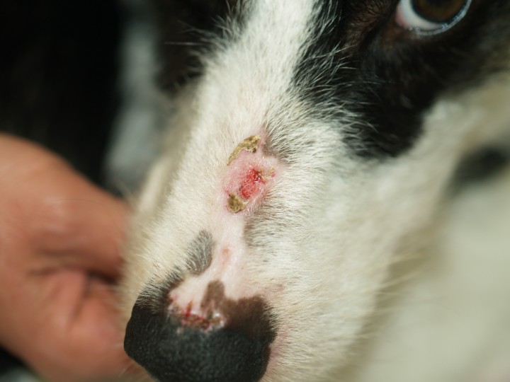 <p>Lesiones en el puente y el plano nasal a los 10 días de comenzar el tratamiento. Se observan las lesiones ulcerativas en vías de epitelización.</p>