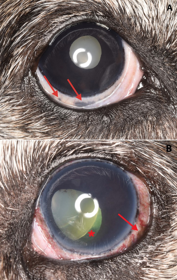 <p>(<strong>A</strong>) Fotografía del ojo derecho en la que se observa pigmentación escleral ventral (flechas), hiperpigmentación difusa del iris y esclerosis nuclear. (<strong>B</strong>) Fotografía del ojo izquierdo en la que se visualiza congestión bulbar, pigmentación escleral ventral (flecha), edema corneal difuso, hiperpigmentación difusa del iris con discoria y sinequia posterior dorsal, esclerosis nuclear y creciente afáquico ventrolateral (asterisco).</p>