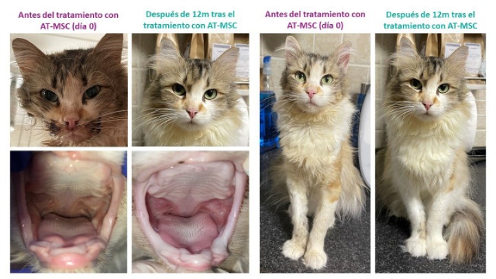 <p>Fotografías del aspecto físico con detalle de la cavidad oral antes del tratamiento y tras 12 meses de seguimiento tras la administración de la primera dosis de AT-MSC, en las que se observa una mejoría evidente de la paciente.</p>