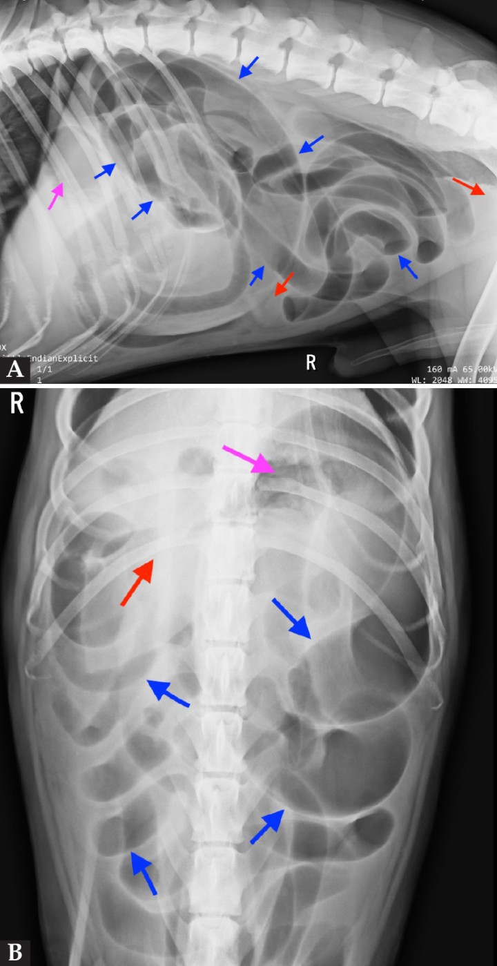 <p>Imagen radiográfica lateral derecha (<strong>A</strong>) y ventrodorsal (<strong>B</strong>) de la cavidad abdominal. En ambas imágenes se observa distensión generalizada del intestino delgado, con contenido gas en su interior y disposición en paralelo de algunas asas (flechas azules), junto con una pérdida de diferenciación de serosas (flechas rojas). Además, se aprecia pérdida de diferenciación de serosas (flechas rojas). El estómago se encuentra en posición anatómica normal (flecha violeta).</p>
