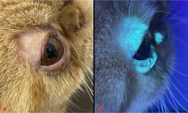 <p><strong>Lámpara de Wood</strong>. Se trata de una potente herramienta cuyas ventajas (rapidez y facilidad de uso) la hacen muy interesante, tanto para el diagnóstico de la dermatofitosis como para el cribado en colectividades de felinos y la monitorización de la eficacia del tratamiento en el paciente. Al iluminar los pelos del felino infestado (<strong>A</strong>) se produce una fluorescencia verde manzana (<strong>B</strong>) a consecuencia de un metabolito (pteridina) producido por <em>Microsporum canis </em>(no del resto de dermatofitos); por lo tanto, el brillo es indicativo de la actividad del dermatofito, pero no directamente de su presencia, pues ni esporas ni hongos brillan.</p>