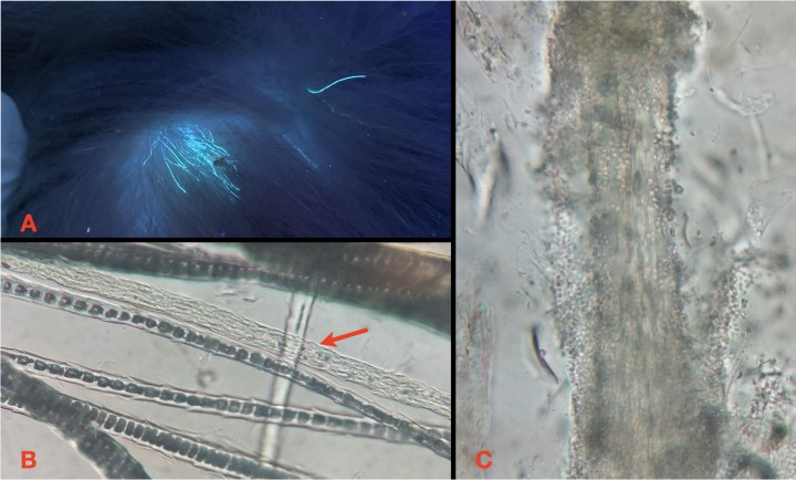 <p><strong>Estudio microscópico del pelo (EMP)</strong>. La visualización directa al microscopio de hifas y esporas fúngicas en los pelos del paciente es el mejor método de confirmación (mejor especificidad), pero no diagnóstico, dada la baja sensibilidad, sobre todo si la técnica de recogida no está guiada por lámpara de Wood (<strong>A</strong>) o dermatoscopio. Se puede observar que suelen ser pocos los pelos infestados por los dermatofitos (flecha en <strong>B</strong>), en los que se ha perdido toda la estructura normal del pelo (cutícula, corteza y la característica médula del pelo del gato), que ha quedado reemplazada por un haz de hifas fúngicas y multitud de esporas (<strong>C</strong>).</p>