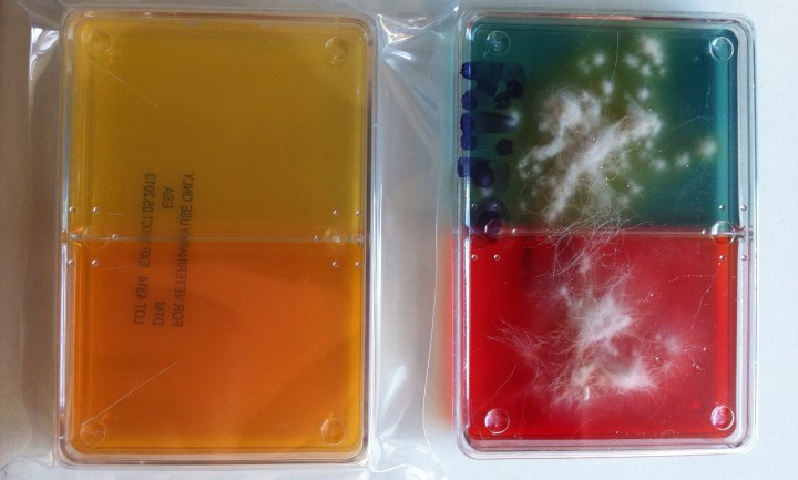 <p><strong>Cultivo DTM (<em>Dermatophyte test medium</em>)</strong>. Consiste en cultivar muestras de piel/pelo obtenidas mediante cepillado (con cepillo dental o similar), depilación (preferible de los pelos fluorescentes al iluminarlos con la lámpara de Wood) o por cinta adhesiva (parece ser la más sensible). Obsérvese en la imagen el resultado positivo por el viraje de color del medio (de naranja o amarillo inicial a rojo o azul final, respectivamente) de forma sincrónica al crecimiento de colonias morfológicamente compatibles con el dermatofito sospechado. Se debe tener cuidado con los falsos positivos, pues los hongos saprófitos pueden dar viraje de color, pero siempre posterior al crecimiento de la colonia.</p>