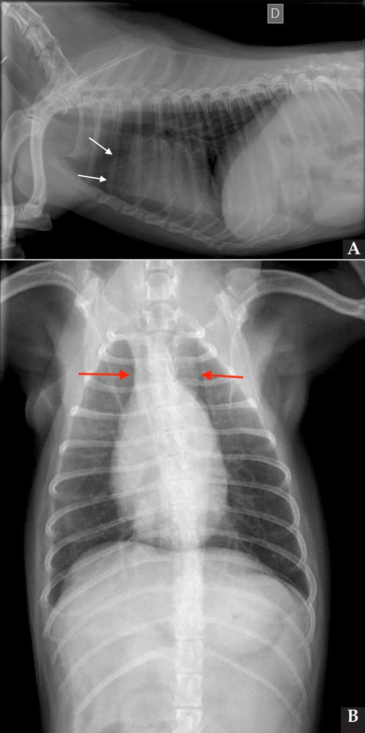 <p>Radiografías torácicas en proyección lateral derecha (<strong>A</strong>) y ventrodorsal (<strong>B</strong>) donde se visualiza el área de opacidad de tejido blando craneal a la silueta cardíaca (flechas blancas). En la proyección ventrodorsal se visualiza el mediastino craneal que se presenta en el límite superior de grosor (flechas rojas).</p>