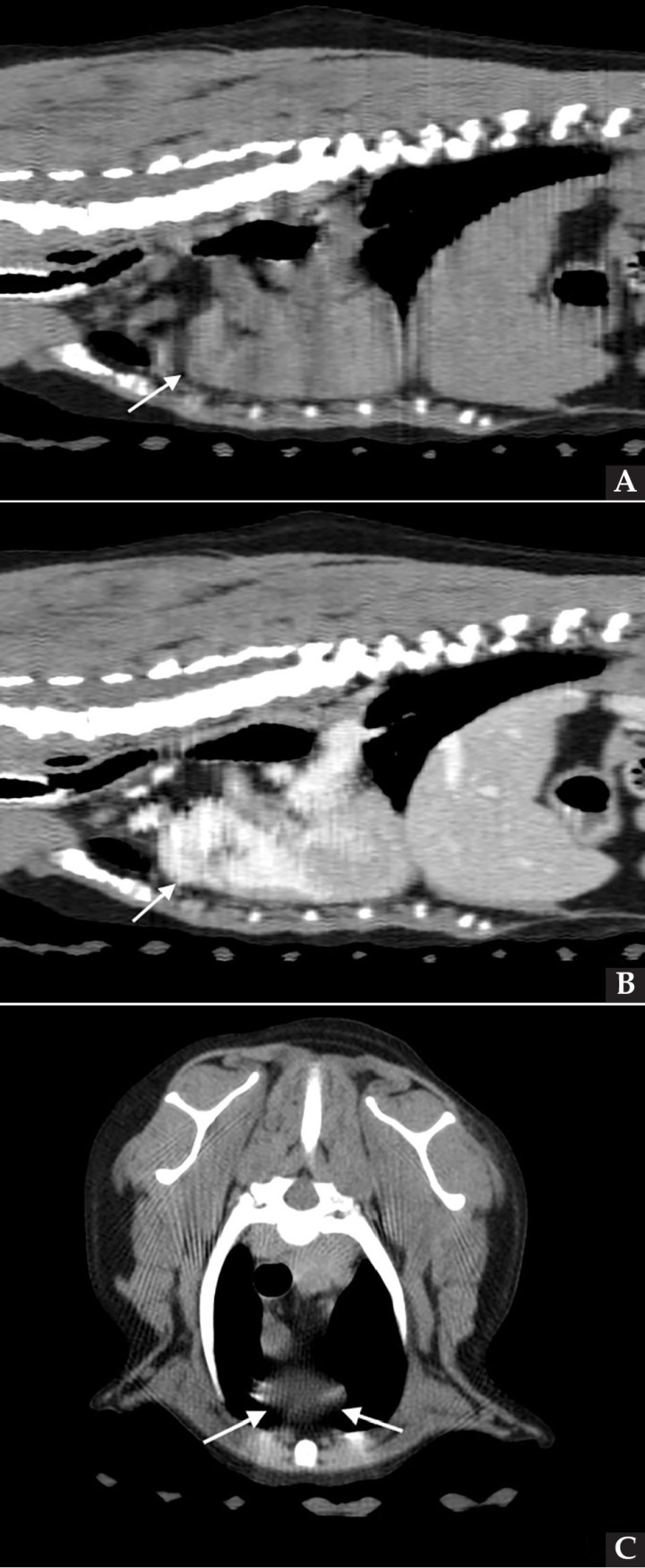 <p>Imágenes de Tomografía Computarizada. Inmediatamente tras la administración de contraste (<strong>A</strong>) en ventana de tejido blando. Se observa una estructura quística en la zona craneal del atrio derecho y que contacta con la aurícula derecha, rellenándose de contraste inmediatamente tras su administración (flechas blancas). (<strong>B</strong>) Imagen reconstruida en volumen rendering, donde se visualiza el aumento de tamaño de la aurícula derecha (flecha blanca).</p>