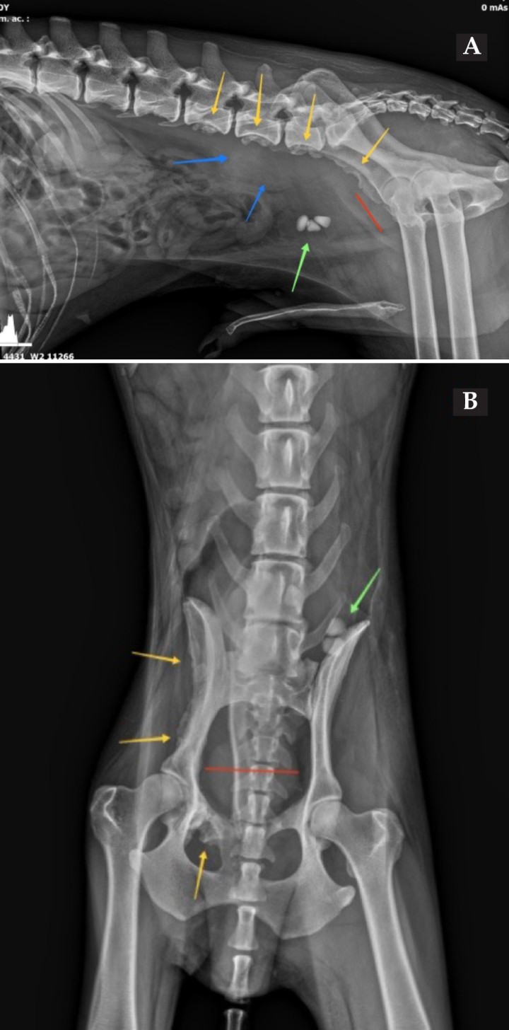 <p>Mismas imágenes que la Figura 1. En ambas proyecciones (<strong>A</strong> y <strong>B</strong>) se observan 3 urolitos en vejiga de la orina (flecha verde), prostatomegalia (línea roja) y lesiones osteoproliferativas en el borde ventral de los cuerpo vertebrales de L5-L6-L7, ilion y pubis (flechas amarillas). En proyección lateral derecha (<strong>A</strong>) se aprecia un aumento focal del tamaño y opacidad del retroperitoneo ventralmente a L6-L7 (flechas azules).</p>