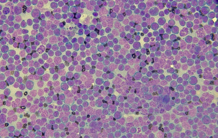 Citología procedente de la masa mediastínica donde se observa una población homogénea de linfocitos intermedios. Tinción Diff-Quick®, Plössl (PL.) 10X/20mm dioptrías; x40.
