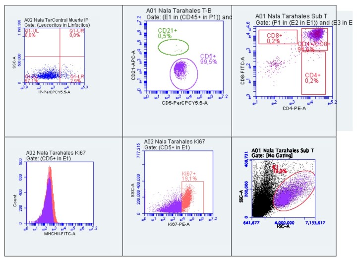 Inmunofenotipado de la masa mediastínica por citometría de flujo. Histogramas y diagramas de puntos.