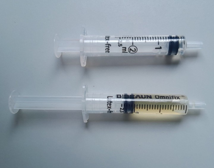 Líquido sinovial obtenido por artrocentesis. Las muestras presentadas se obtuvieron del mismo perro con osteoartritis bilateral del codo. Aunque el animal presenta síntomas en ambas articulaciones, la simple observación muestra una marcada variación en el volumen y aspecto macroscópico del líquido sinovial. Estos datos son importantes para que el clínico evalúe el estado del paciente y seleccione el tratamiento. Actualmente, la búsqueda de biomarcadores de enfermedades ha sido objeto de varias líneas de investigación.