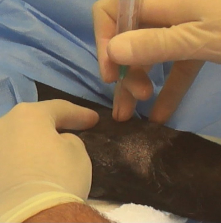 Acceso a la articulación del codo. Para acceder a la articulación, el animal se coloca en decúbito lateral. La extremidad de interés se posiciona dependiendo de si se prefiere un abordaje lateral o medial. En el abordaje medial, la extremidad se coloca en la parte inferior y se aplica un rodillo de venda debajo de la articulación para abrir el espacio articular medial. La porción distal de la extremidad se encuentra a la derecha de la imagen. La aguja se inserta en un punto distal al epicóndilo medial, como se muestra en la imagen. Un abordaje alternativo es el acceso caudal, ya sea lateral o medial. La aguja se dirige hacia el agujero supratroclear, comenzando proximomedial o proximolateral y paralelo al proceso ancóneo, y luego se dirige medialmente si se realiza desde el aspecto lateral. Dependiendo del tamaño del animal podremos utilizar agujas de 21-23 G, 1,5'' y jeringas de 2-5 ml.