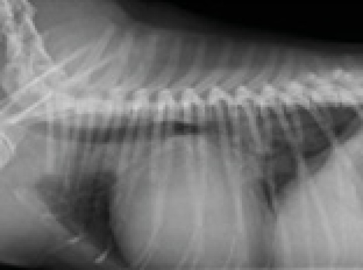 <p>Radiografía torácica latero-lateral derecha realizada en el momento que se produjo la rotura del atrio izquierdo.</p>
