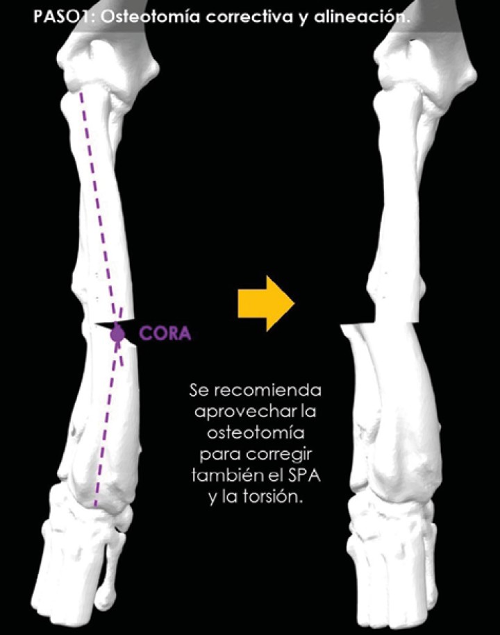 Simulación en 3D de la ostectomía correctiva que se ha de realizar según el software, una vez obtenido el CORA.