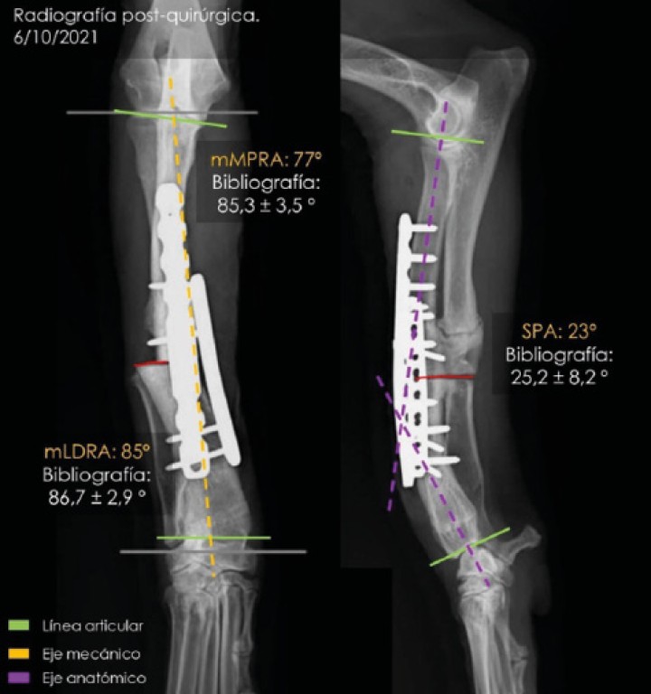 Proyecciones radiográficas craneocaudal y mediolateral posquirúrgicas. Las radiografías muestran el resultado tras la cirugía.