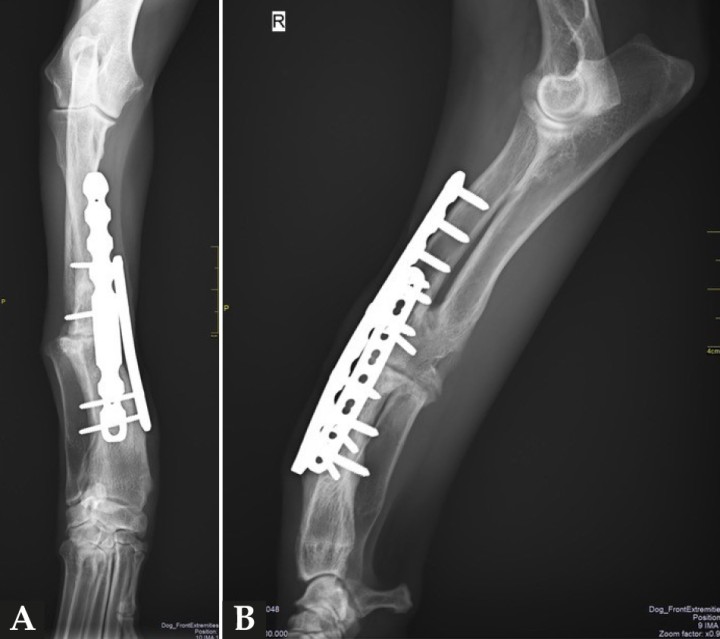 Proyecciones radiográficas (A) craneocaudal y (B) mediolateral a los 4 meses de la cirugía. Las imágenes muestran la avanzada consolidación de la ostectomía.