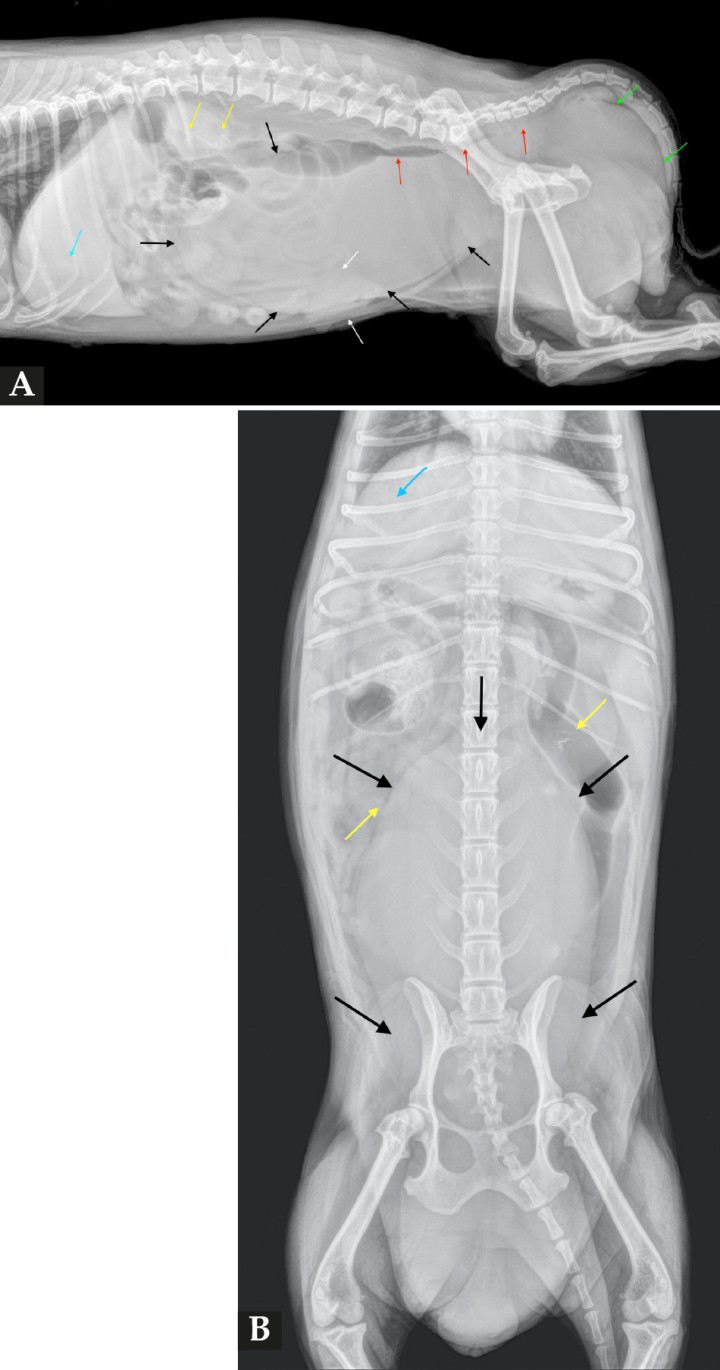 <p>Mismas radiografías que la Figura 1. Nótese en el abdomen medio y caudal una masa opacidad tejido blando de morfología ovalada y márgenes redondeados (flechas negras). La masa genera un desplazamiento craneoventral de la vejiga de la orina (flechas blancas) y comprime al colon descendente y al recto dorsalmente (flechas rojas). Aumento del espesor de los tejidos blandos en la región perineal (flechas verdes). Además, se observanmúltiples renolitos bilaterales (flechas amarillas) y un colelito biliar (flecha azul).</p>