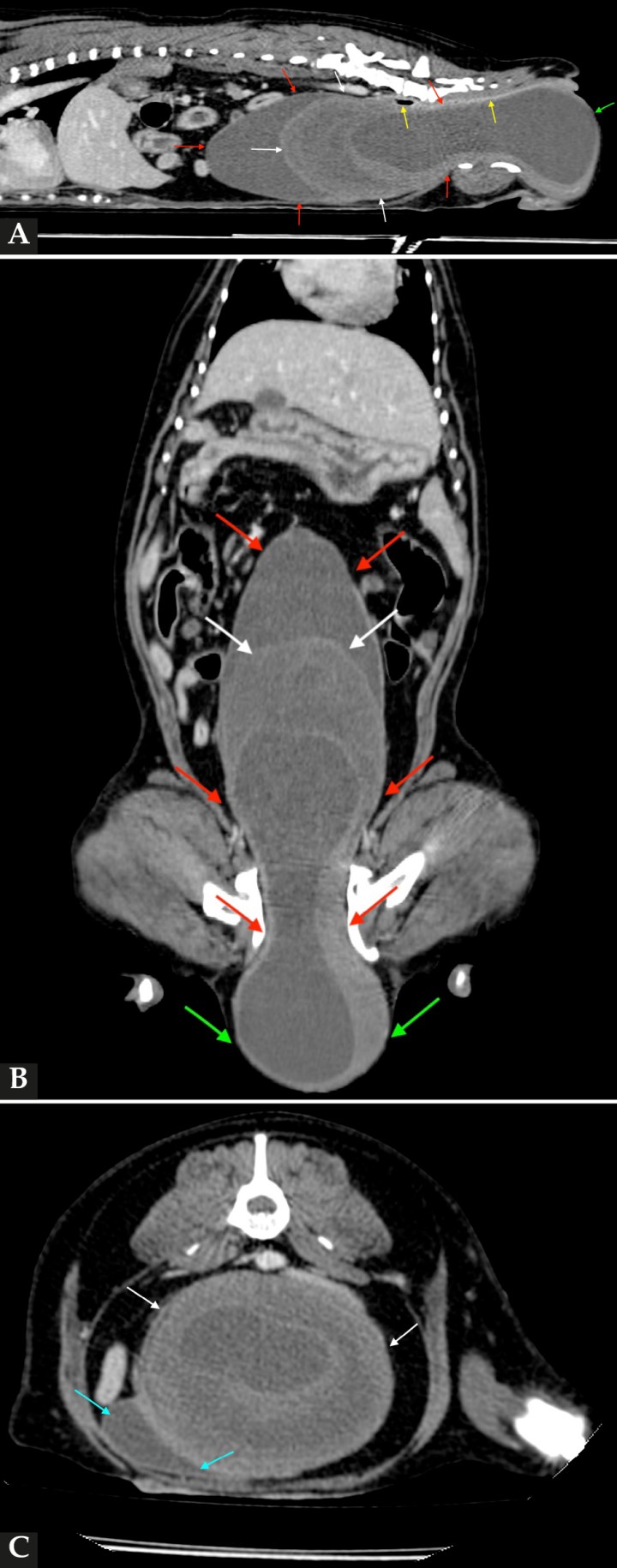 <p>Imágenes de TC de abdomen en ventana de tejidos blandos tras la administración de contraste intravenoso. (<strong>A</strong>) Plano sagital. (<strong>B</strong>) Plano dorsal. (<strong>C</strong>) Plano axial. Se observa la vagina marcadamente distendida desde el vestíbulo vaginal hasta el nivel del cuello uterino, con fluido en su luz (flechas rojas). Se observa en su luz una estructura con contenido hipoatenuante, con halo asimétrico e hiperatenuante (flechas blancas). Obsérvese cómo la masa provoca un desplazamiento y compresión del colon descendente y recto hacia dorsal (flechas amarillas) y de la vejiga de la orina y uretra hacia craneoventral y lado derecho (flechas azules). La masa protruye caudalmente sobre la región perineal, de manera bilateral (flechas verdes)</p>