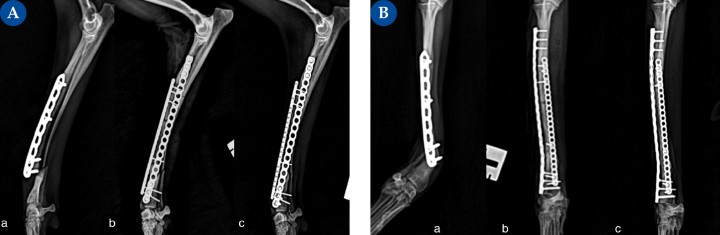 (A) Proyección mediolateral, (B) Proyección craneocaudal. Fractura diafisaria distal de cúbito y radio, oblicua corta, asociada a la colocación de un implante previo, en un paciente lebrel italiano de 2,5 kg.(a) Fractura diafisaria distal de cúbito y radio, oblicua corta. El radio se aprecia esclerótico debido a su anterior intervención, realizada cuatro meses antes. Las reintervenciones de fracturas previamente tratadas suponen un aumento del riesgo de sufrir complicaciones, especialmente a la hora de lograr una correcta cicatrización ósea,<sup>3,7</sup> por lo que se trata mediante un sistema de placas ortogonales.&nbsp;(b) En este caso y por la peculiaridad del radio, más estrecho de lo normal en el plano craneal y más ancho en el plano sagital debido a la cicatrización de su anterior fractura y al efecto del implante previamente colocado, la placa principal se coloca en la cara lateral del radio. Se trata de una placa bloqueada de titanio multiorificio y poliaxial con tres tornillos bloqueados por fragmento, todos de 1,5 mm salvo el más distal, de 2,0 mm (mayor stock óseo). El implante auxiliar se coloca en la cara craneal del radio y se trata de una placa bloqueada de titanio, multiorificio, con dos tornillos bloqueados de 1,2 mm en el fragmento distal y cuatro en el fragmento proximal.(c) Evolución de la consolidación ósea a las 6 semanas postoperatorias.