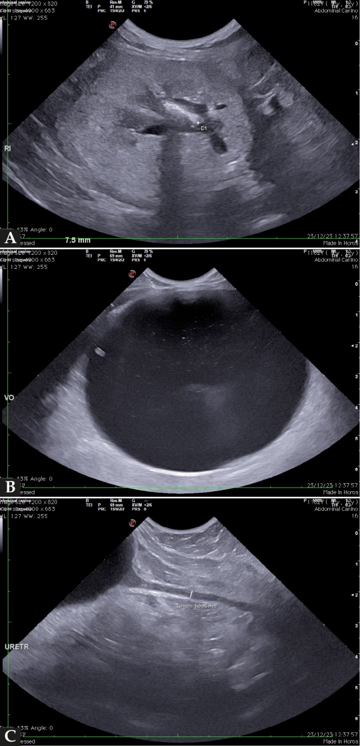 (A) Imagen ecográfica del riñón izquierdo en corte transversal en la que se observa un aumento marcado de la ecogenicidad del parénquima renal, con pérdida de diferenciación corticomedular y la presencia de un renolito de 7,5 mm (entre cursores), que genera sombra acústica distal. (B) Imagen ecográfica de la vejiga de la orina severamente distendida con material ecogénico de pequeño tamaño en suspensión. (C) Imagen ecográfica de la uretra proximal en corte longitudinal con una dilatación de casi 2 mm.