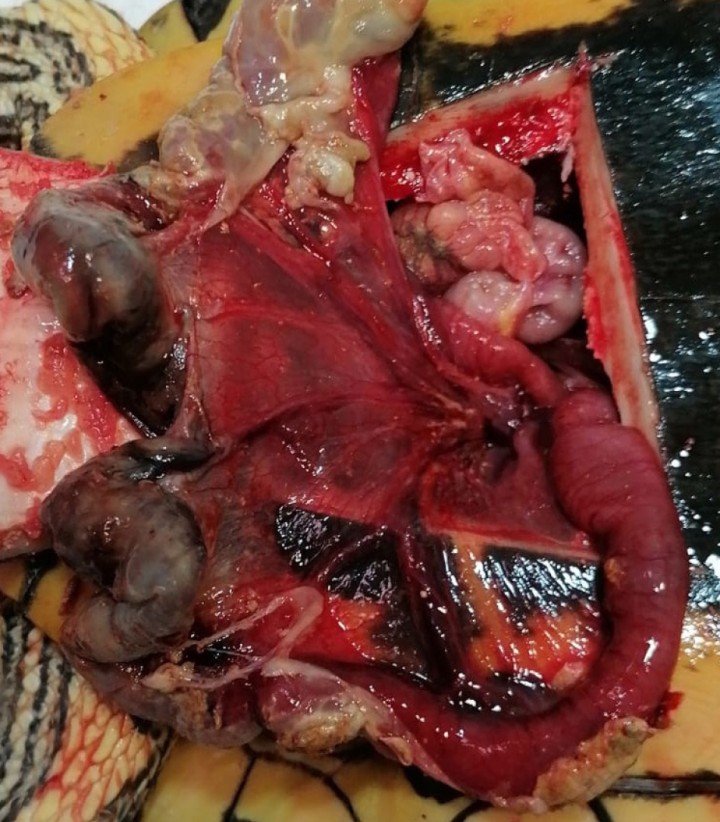 Tramo intestinal una vez reducido y exteriorizado con aspecto necrótico.