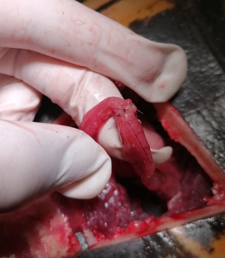 Anastomosis terminoterminal entérica.