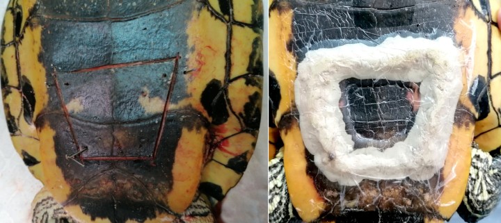 Cierre de la osteotomía.