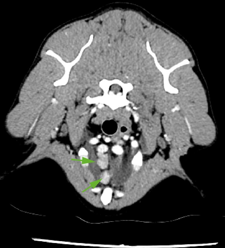 <p>Imagen de TC en ventana tejido blando postcontraste de corte trasversal; a la entrada del tórax, se evidencian los linfonodos mediastínicos craneales y esternal (flechas) aumentados de tamaño, con márgenes bien definidos, parénquima homogéneo, atenuación (50 UH) en fase precontraste y captación de contraste homogénea y moderada. Se aprecia, además, ligera hiperintensidad de la grasa perinodal.</p>