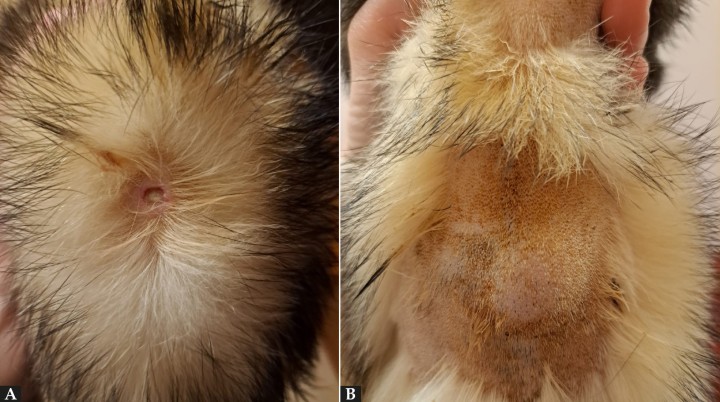 <p>(<strong>A</strong>) Imagen del dorso del paciente. Lesión cutánea ulcerativa en la zona de administración SC. (<strong>B</strong>) Imagen de la misma zona tras el tratamiento tópico.</p>