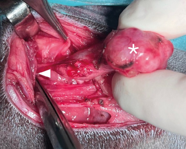 Disección de la glándula mandibular ( * ) junto con la glándula sublingual del resto de tejidos. Durante la disección es necesario realizar hemostasia mediante ligadura o diatermia de la vascularización que irriga a dicho complejo salivar. La disección del complejo debe realizarse paralela y rostralmente exponiendo los pequeños grupos de tejido salivar de la glándula sublingual hasta su aspecto más rostral. Los conductos salivales deben ser diseccionados hasta la rama lingual ( < ) del nervio trigémino. Llegados a esta localización se realiza la ligadura distal del conducto mientras se tracciona ligeramente del complejo salivar con el fin de facilitar su exposición.