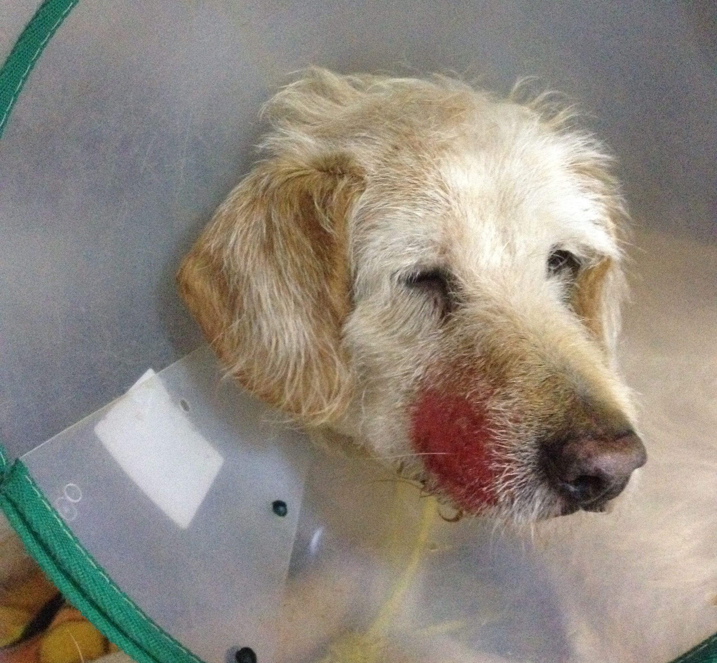 <p>Lesión erosivo-ulcerativa por autotraumatismo en la región maxilar derecha.</p>