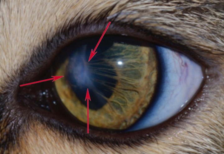 <p><strong>Persistencia de membrana pupilar (PPM).</strong> En esta imagen observamos una fotografía del ojo izquierdo de un gato. Las PPM son lesiones congénitas debidas a un mal desarrollo embrionario de la cámara anterior. Son fibras uveales que se originan de la parte media del iris llamada collarette. De esta zona del iris se dirigen hacia otra parte del mismo iris, a la córnea o al cristalino (observe flechas rojas en la imagen). Estas lesiones focales blanquecinas no tiñen con fluoresceína. Las PPM no requieren tratamiento.</p>