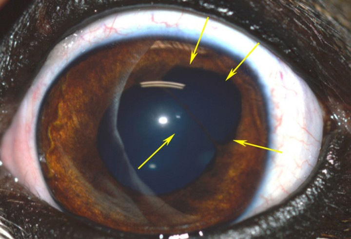 <p><strong>Coloboma de iris. </strong>En esta imagen podemos ver el ojo izquierdo de un perro braquiocefálico de 3 años de edad, en el que se observa ligero euriblefaron (extensa apertura palpebral). Si observamos el iris, podemos ver como la pupila tiene una forma ligeramente anómala, no es completamente redonda, y hay un defecto del tejido del iris entre las 12h y las 3h (imaginando que la circunferencia ocular es un reloj). Este defecto iridal deja entrever parte del cristalino. Este paciente tiene un coloboma de iris (flechas amarillas), déficit congénito de formación de tejido iridal. En algunos casos se puede observar este tipo de cambio en pacientes seniles, en el que el iris se atrofia por la edad. En estos casos es posible observar una alteración de los reflejos pupilares en ese ojo e incluso molestias en situaciones de luz intensa.</p>