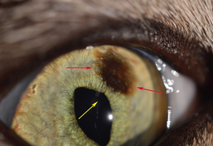 <p><strong>Melanoma maligno.</strong> Fotografía del ojo derecho de un gato. Este gato desarrolló esta lesión hiperpigmentaria (flechas rojas) unos 2 meses antes de la consulta. En este caso, hay un cambio sutil ligeramente preocupante. La pupila de la zona adyacente está deformada (flecha amarilla). Los propietarios, debido a experiencias anteriores, al saber que podría tratarse de una lesión neoplásica, no querían asumir ningún tipo de riesgo y decidieron enuclear al paciente. Esta lesión fue diagnosticada histopatológicamente post-enucleación como un melanoma maligno con alto grado de mitosis y mitosis atípicas. Se investigó a lo largo del primer año después de la enucleación por posibles lesiones metastáticas con imagen avanzada (TAC) y no se encontraron cambios compatibles con lesiones secundarias al melanoma ocular.</p>