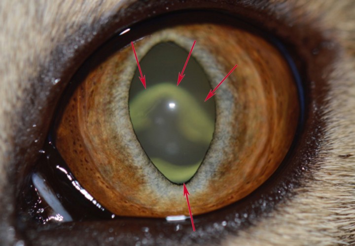 <p><strong>Cambios iridales. </strong>Fotografia del ojo izquierdo de un gato de 8 años de edad. Este gato presentaba estos cambios bilateralmente. El propietario describe un cambio de coloración del iris progresivo en los últimos 3 meses. Al examen, también observamos catarata incipiente subcapsular posterior delimitando la forma de un trébol (opacidad desenfocada que observamos a través de la pupila, flechas rojas). En este ejemplo nos centraremos en el cambio iridal. Se observan cambios difusos de color pardo sobre el estroma anterior del iris, que había sido verde, y cambios focales (observe lesiones focales más oscuras en forma de puntos). La función iridal en este paciente no estaba alterada, no había pigmento libre en cámara anterior ni ningún otro cambio sospechoso de malignidad. Históricamente ha sido imposible diferenciar lesiones pigmentarias benignas (melanosis) del melanoma de iris difuso felino. Esta última es una lesión maligna con capacidad metastática. No hay una opinión única en el manejo de estos casos.</p>