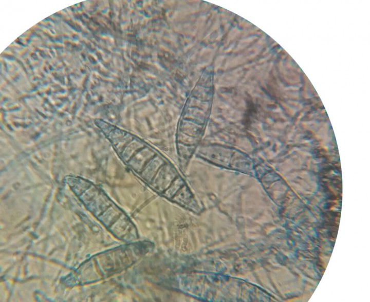 <p>Observación microscópica del crecimiento de macroconideas de <em>Microsporun canis</em> en cultivo dermatofítico. Objetivo 100x.</p>