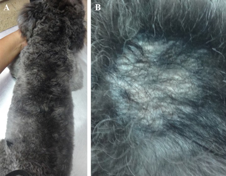 <p>Paciente dos meses después del tratamiento. <strong>(A)</strong> Vista dorsal del paciente. <strong>(B)</strong> Vista de cerca de lesión en resolución. Nótese la mejoría clínica de las lesiones con crecimiento de pelo.</p>