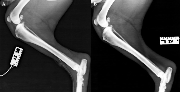 <p>Proyección mediolateral de tibia y peroné. <strong>(A) </strong>Derecha. <strong>(B) </strong>Izquierda.</p>