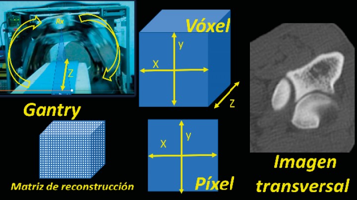 <p>TC con el <em>gantry</em> abierto para mostrar el tubo de rayos X girando alrededor de la camilla. Concepto de matriz de reconstrucción y diferencias entre un vóxel y un píxel. Imagen de un codo obtenida en el plano transversal.</p>